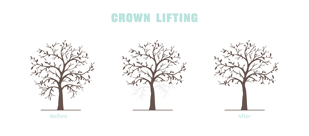 Crown Lifting